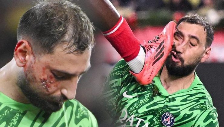 Monaco – PSG maçında skandal! Yürekleri ağza getiren faule kart bile çıkmadı!